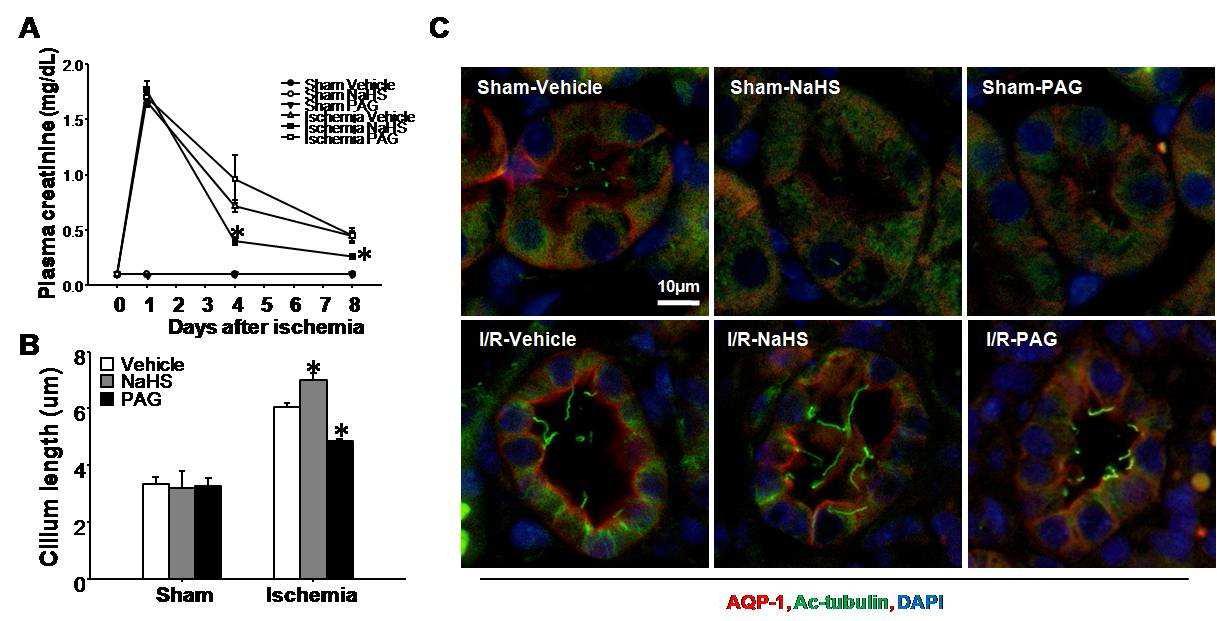 The role of hydrogen sulfide on length of tubular primary cilia after ischemia / reperfusion injury