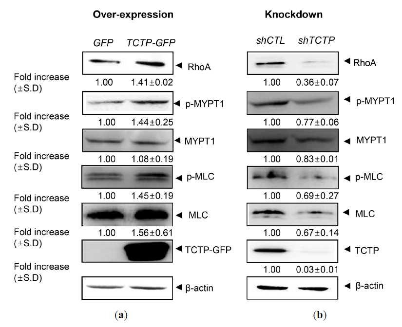 혈관 평활근 세포에서 TCTP가 RhoA 신호전달에 미치는 영향