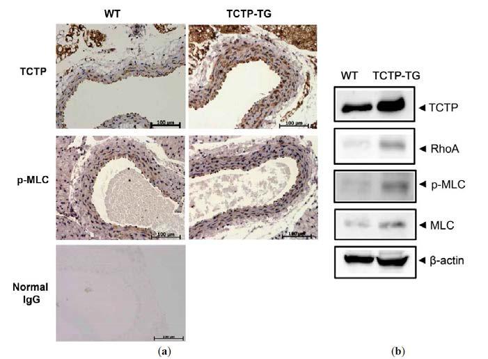 TCTP-TG 마우스 대동맥에서 RhoA 신호전달 변화 규명