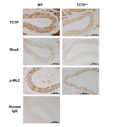 TCTP+/- 마우스 대동맥에서 RhoA 신호전달 조절 확인