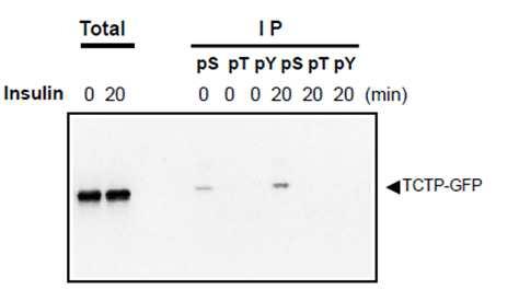 293T 세포에 인슐린 처리 후 인산화되는 TCTP 잔기 규명