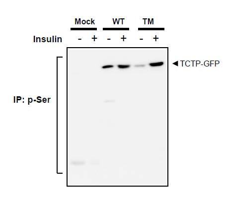 Triple mutant를 발현 시킨 293T 세포에서 인슐린에 의한 인산화 관찰