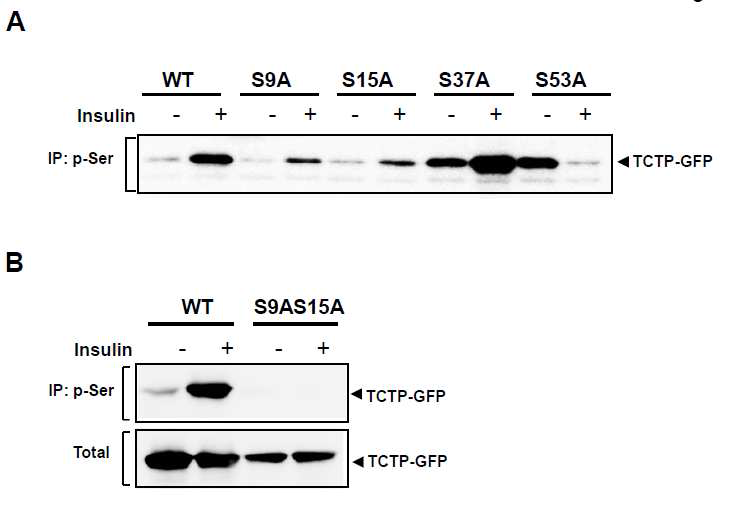 인슐린에 의해 인산화되는 TCTP 잔기 규명