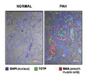 정상(normal) 및 폐동맥고혈압(PAH)에서 TCTP의 확인