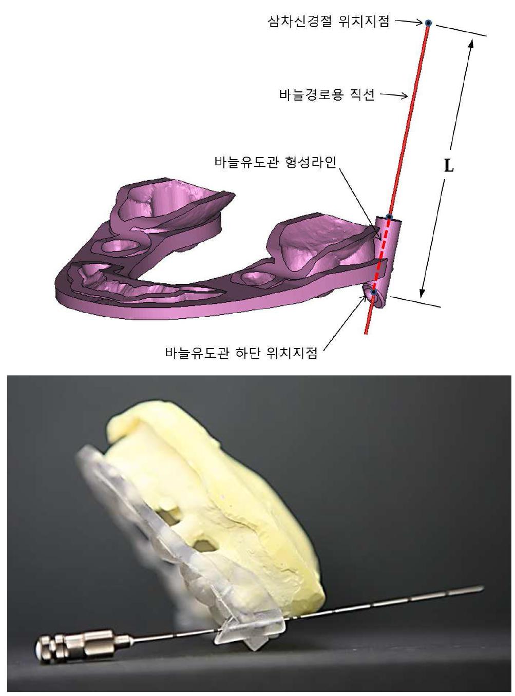 연구과제를 통하여 개발된 타원구멍바늘찌르기 유도장치