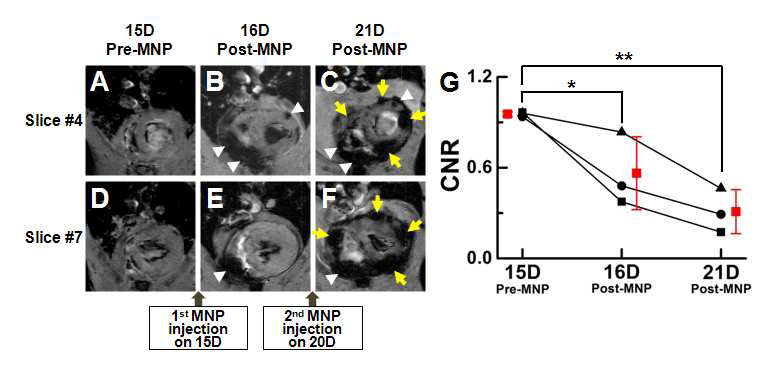 MNP-PEG를 이용하여 MRI 상에서 심근염 유도 후 염증 진행 실시간 관찰