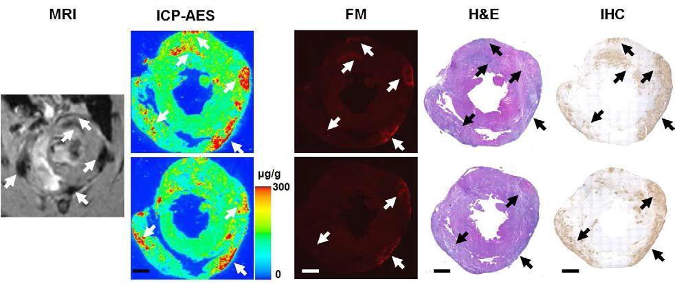 심근염 rat에 MNP/FI 다중 프로브를 꼬리 정맥 주사한 후, MRI, LA-ICP-MS, FM, H&E, IHC를 통해 비교분석한 결과