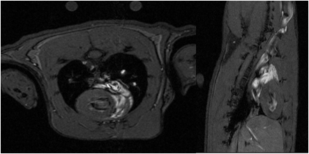 Rat 심장 T1 강조 영상