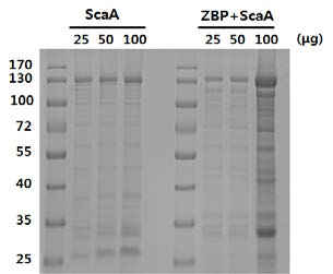 산화아연결합 서열(펩타이드8번) 유.무에 따른 각각의 ScaA 재조합단백질을 농도별로 산화아연 나노입자와의 결합정도를 SDS-PAGE에 서 확인함