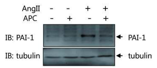 The dffect of APC inAngiotensin II -induced PAI-1 expression in cardiomyocytes