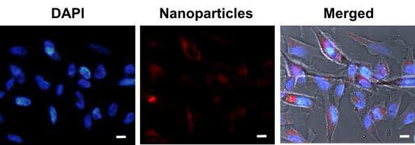 Nile red를 봉입한 나노입자의 세포 유입 형광 이미지