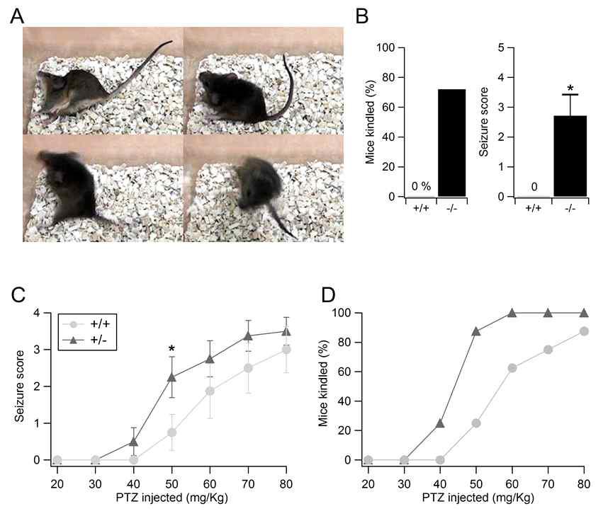 Aminopeptidase P1 발현 감소에 따른 간질 취약성 증가