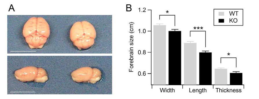 Aminopeptidase P1 결핍에 의한 뇌 크기 변화