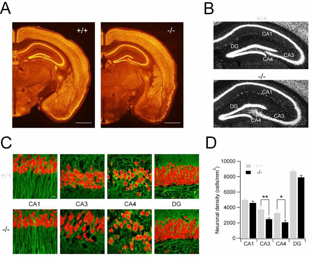 aminopeptidase P1 결핍에 의한 뇌 조직 변화