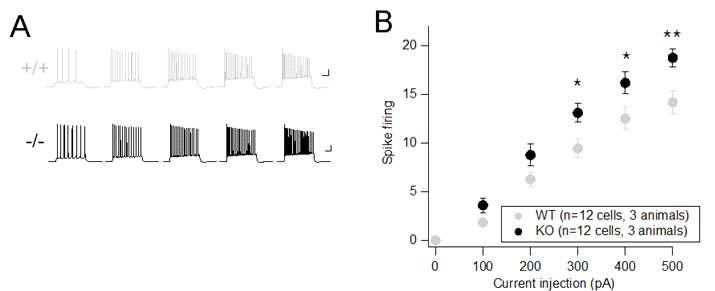 aminopeptidase p1 결핍에 의한 신경세포의 흥분성 변화