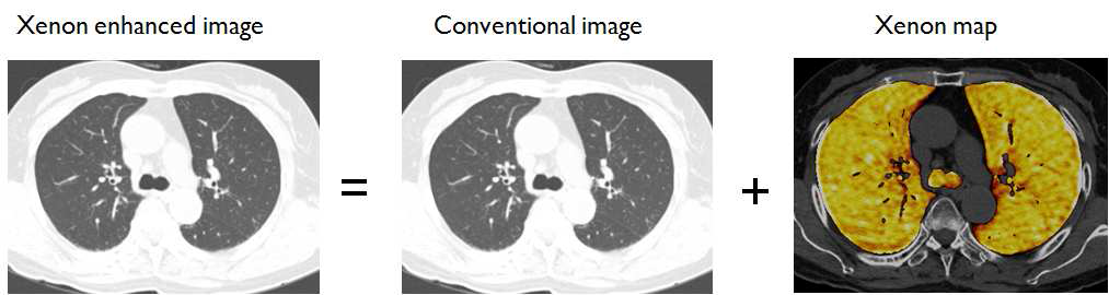 Xenon enhanced lung ventilation map