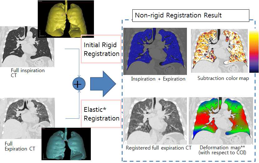 폐정합 기법 : 흡기, 호기시 3D volumetric CT를 촬영하여 양 폐를 추출하여 초기 강체 정합후 Elastic 비강체 정합 기법을 이용하여 호기데이터를 흡기 데이터 정합한 영상을 생성