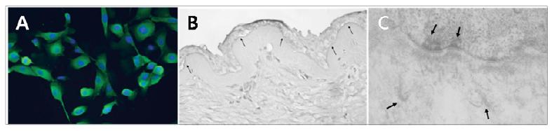 A: Cytokeratin조직화학염색 B: Collagen type Ⅶ 조직화학염색 C: Hemidesmosome과 anchoring fibril 확인을 위한 전자현미경 소견