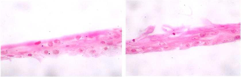 인간유래 배양구강점막상피세포 시트의 H&E stain