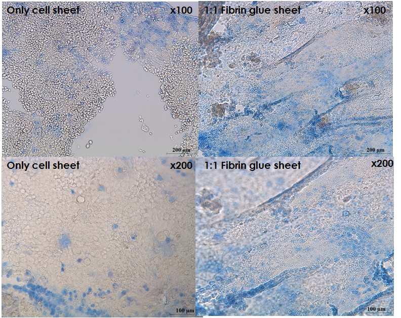 only cell sheet와 1:1 fibrin glue sheet 배양구강점막상피세포의 trypan blue 염색