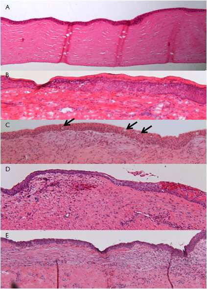 (A) 정상 가토 각막 조직. (B)~(C) : 인간유래 배양구강점막상피세포 sheet를 가토안에 이식. 1:2 (B) 와 1:1 (C) fibrin glue sheet 이식 후 7일째 희생하여 얻은 각막조직. only cell sheet (D) 와 1:1 fibrin glue sheet (D) 이식 후 3일째 희생하여 얻은 각막조직