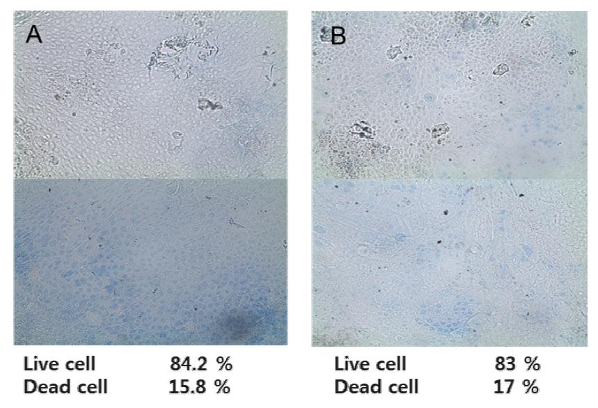 (A) Stevens-Johnson syndrome 환자의 배양 구강점막세포 시트의 live cell percentage 가 75% 이상임을 확인 (B) non Stevens-Johnson syndrome (malignant melanoma) 환자의 배양 구강점막세포 시트의 live cell percentage 가 75% 이상임을 확인