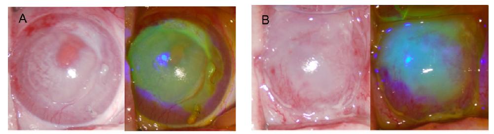 Pilot study (A) fibrin glue 없이 cell sheet만 이식한 개체의 이식 후 3일 째 사진. (B) 1:1 fibrin glue를 사용한 cell sheet를 이식한 개체의 이식 후 3일 째 사진