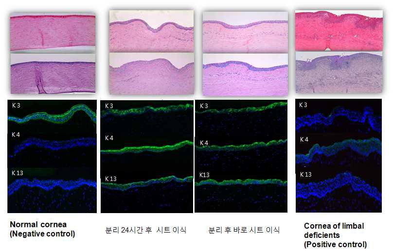 시트 분리 24시간 후 이식 시 cytokeratin 발현 분석