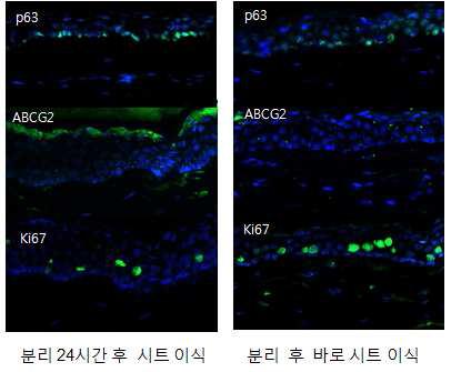 시트 분리 24시간 후 이식 시, 줄기세포 표지자 발현 분석