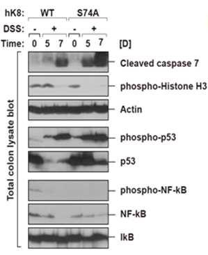 Keratin 8 대조군 생쥐와 S74A 돌연변이 생쥐의 결장 내 cell homeostasis 확인