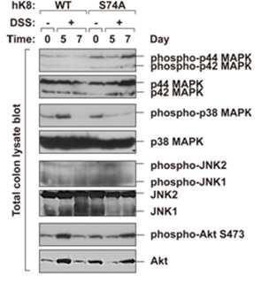 Keratin 8 대조군과 S74A 돌연변이의 결장 내 세포 신호 전달계에 관여하는 인산화 효소의 활성화 정도 비교