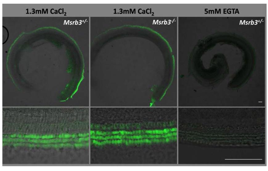 MsrB3+/- 와 MsrB3-/- 내이 유모세포의 stereocilia의 mechanostransduction channel의 활성을 측정