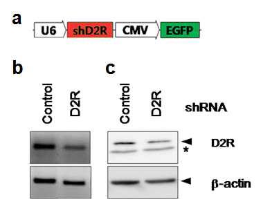 HN33cell에 Lenti-shD2R의 효과