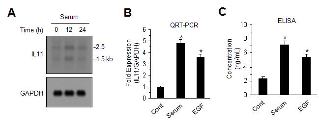 Capan-1 세포에서 serum 자극에 의한 IL-11 유전자 발현
