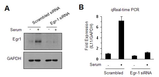 Egr-1 knockdown에 의한 IL-11 발현 억제 효과