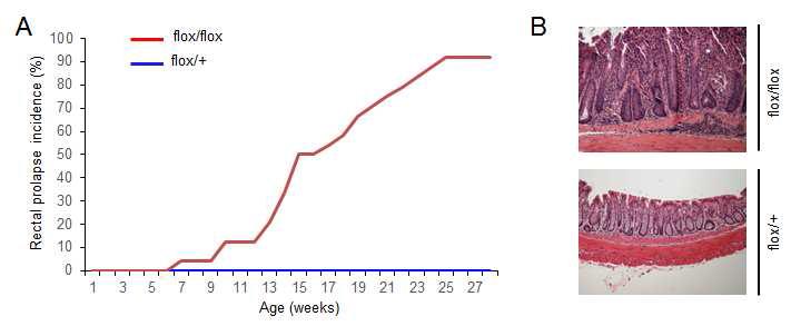 Pdk1+/flox; CD4-Cre (flox/+)와 Pdk1flox/flox;CD4-Cre (flox/flox) 마우스에서 (A) 직장 탈출 빈도수 (n= 26), (B) 장 조직 사진