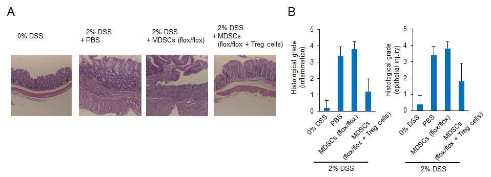 DSS 유도 마우스에서 MDSC세포 이식에 따른 (A)장 조직 사진, (B)장의 염증 및 상피세포 손상의 조직 점수