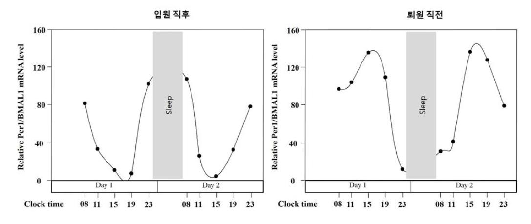 조울증 환자 1명의 입원 직후 및 퇴원 직전 유전자 생체리듬 변화 예시.