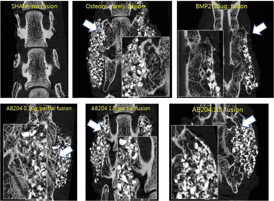 Micro-CT 분석 결과