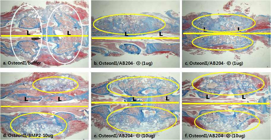 Histology 분석 결과(Masson's trichrome staining)