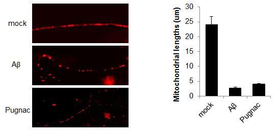 mouse primary neuronal cell에서 beta-amyloid와 Pugnac 처리에 따른 마이토콘드리아 형태
