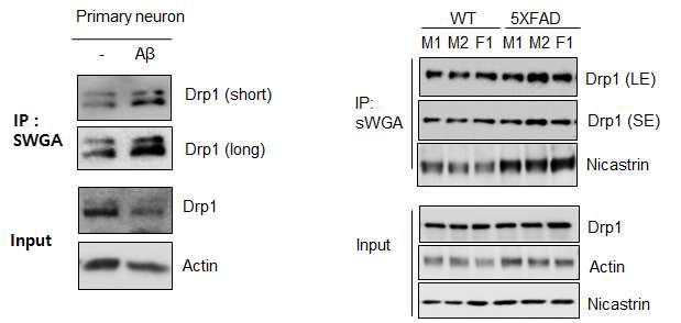 Mouse primary neuronal cell에서 beta-amyloid 처리에 따른 Drp1 O-GlcNAc 증가 (좌). 5XFAD mice에서 Drp1 O-GlcNAc 증가 (우)