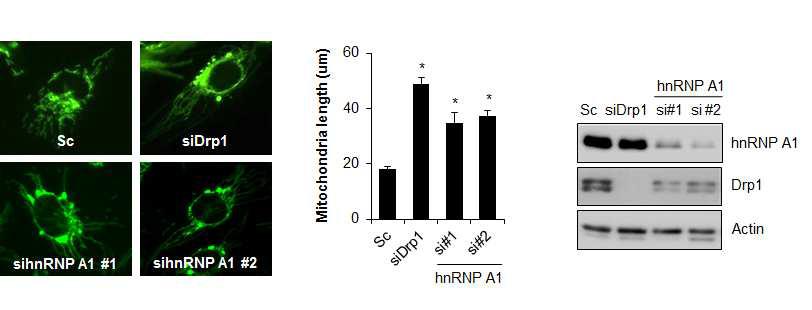 hnRNP A1 siRNA를 이용하여 hnRNP A1의 발현 억제에 따른 마이토콘드리아 길이 변화