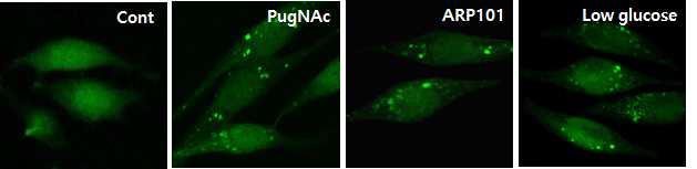 SH-SY5Y/GFP-LC3 세포주에 PugNAc 처리에 따른, autophagic punctate cell이 증가하는 것을 확임 함.