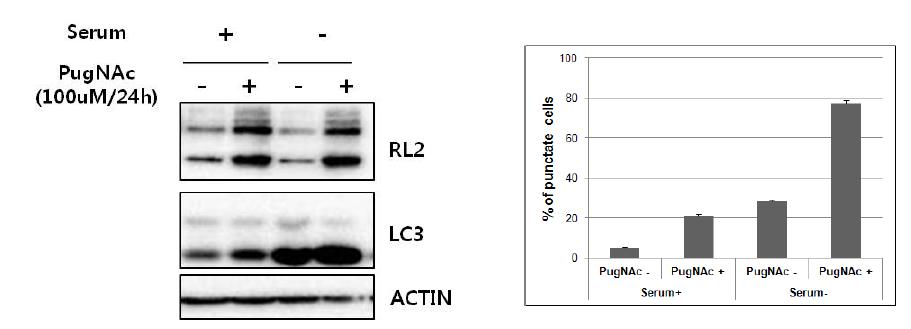 SH-SY5Y 세포주에 PugNAc처리시, LC3Ⅱ 단백질의 증가와 autophagic punctate cell이 증가하는 것을 확임 함.