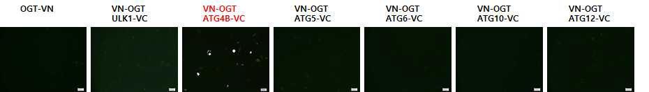 SH-SY5Y 신경세포주에 BiFC 시스템을 이용한 OGT 결합 단백질 발굴
