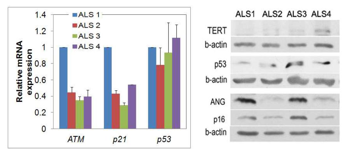 Differential expression of various aging-related molecules in human ALSBM-MSCs.