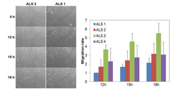 Protective effects of RG108 in hBM-MSCs