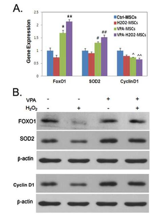 VPA-induced KRIT1 moderates FoxO1, SOD2, and cyclin D1 expression