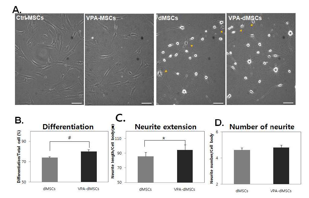 Neuron-like morphological change in VPA-pretreated hBM-MSCs